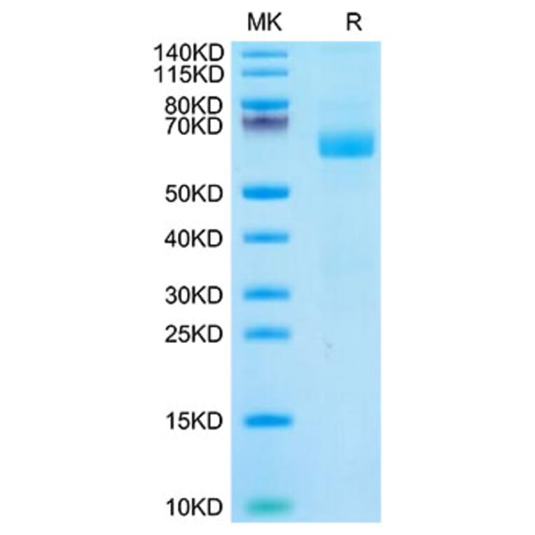 Tris-Bis PAGE - Recombinant Cynomolgus macaque LILRA4 Protein (C-terminal His Tag) (A331728) - Antibodies.com