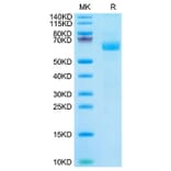 Tris-Bis PAGE - Recombinant Cynomolgus macaque LILRA4 Protein (C-terminal His Tag) (A331728) - Antibodies.com