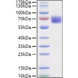 SDS-PAGE - Recombinant Human LILRA6 Protein (C-terminal His and Avi Tag) (A331729) - Antibodies.com