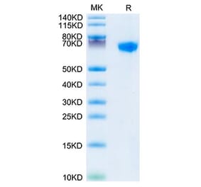 Tris-Bis PAGE - Recombinant Rhesus macaque LILRB1 Protein (C-terminal His Tag) (A331730) - Antibodies.com