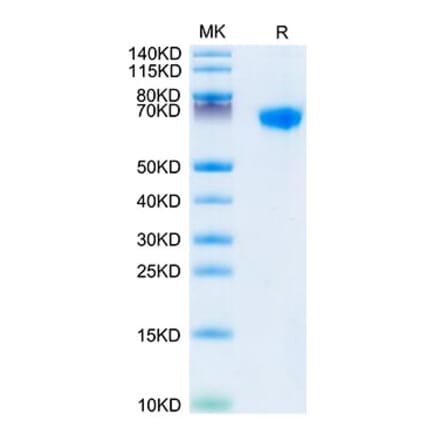 Tris-Bis PAGE - Recombinant Rhesus macaque LILRB1 Protein (C-terminal His Tag) (A331730) - Antibodies.com