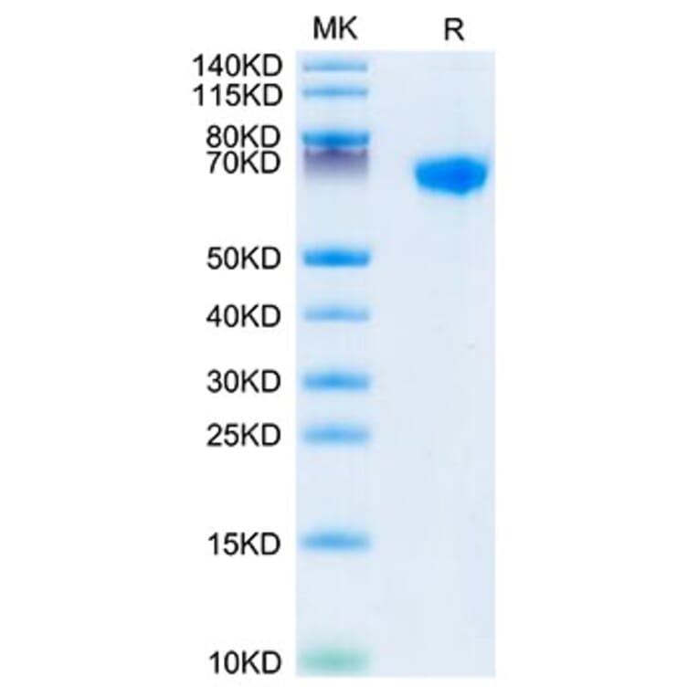 Tris-Bis PAGE - Recombinant Rhesus macaque LILRB1 Protein (C-terminal His Tag) (A331730) - Antibodies.com
