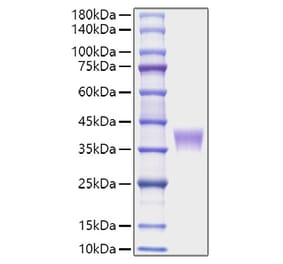 SDS-PAGE - Recombinant Mouse LILRB4 Protein (C-terminal His Tag) (A331731) - Antibodies.com
