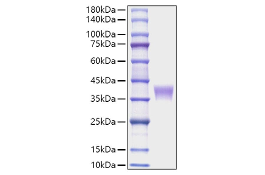 SDS-PAGE - Recombinant Mouse LILRB4 Protein (C-terminal His Tag) (A331731) - Antibodies.com