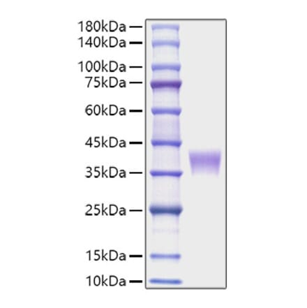 SDS-PAGE - Recombinant Mouse LILRB4 Protein (C-terminal His Tag) (A331731) - Antibodies.com