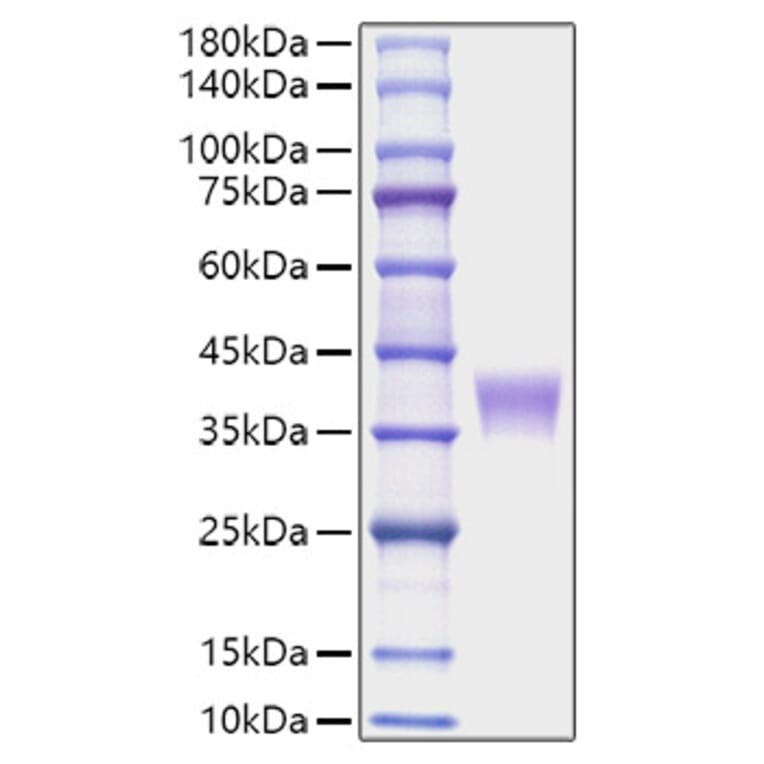 SDS-PAGE - Recombinant Mouse LILRB4 Protein (C-terminal His Tag) (A331731) - Antibodies.com