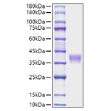 SDS-PAGE - Recombinant Mouse LILRB4 Protein (C-terminal His Tag) (A331731) - Antibodies.com