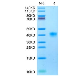 Tris-Bis PAGE - Recombinant Cynomolgus macaque LILRB4 Protein (C-terminal His Tag) (A331732) - Antibodies.com
