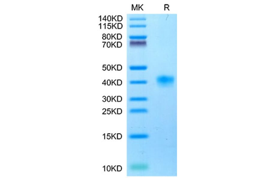 Tris-Bis PAGE - Recombinant Cynomolgus macaque LILRB4 Protein (C-terminal His Tag) (A331732) - Antibodies.com