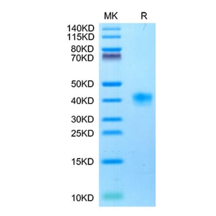 Tris-Bis PAGE - Recombinant Cynomolgus macaque LILRB4 Protein (C-terminal His Tag) (A331732) - Antibodies.com