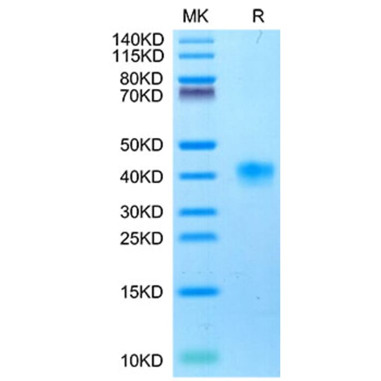Tris-Bis PAGE - Recombinant Cynomolgus macaque LILRB4 Protein (C-terminal His Tag) (A331732) - Antibodies.com