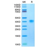Tris-Bis PAGE - Recombinant Cynomolgus macaque LILRB4 Protein (C-terminal His Tag) (A331732) - Antibodies.com