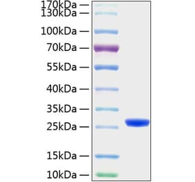 SDS-PAGE - Recombinant Mouse Lipocalin-2 Protein (C-terminal His Tag) (A331733) - Antibodies.com