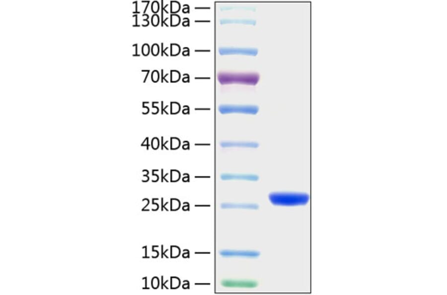 SDS-PAGE - Recombinant Mouse Lipocalin-2 Protein (C-terminal His Tag) (A331733) - Antibodies.com