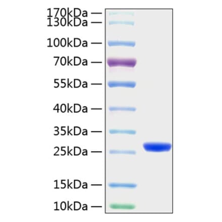 SDS-PAGE - Recombinant Mouse Lipocalin-2 Protein (C-terminal His Tag) (A331733) - Antibodies.com