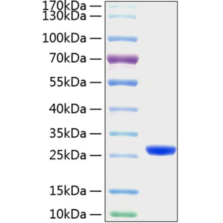 SDS-PAGE - Recombinant Mouse Lipocalin-2 Protein (C-terminal His Tag) (A331733) - Antibodies.com