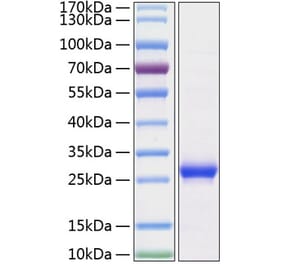 SDS-PAGE - Recombinant Rat Lipocalin-2 Protein (C-terminal His Tag) (A331734) - Antibodies.com
