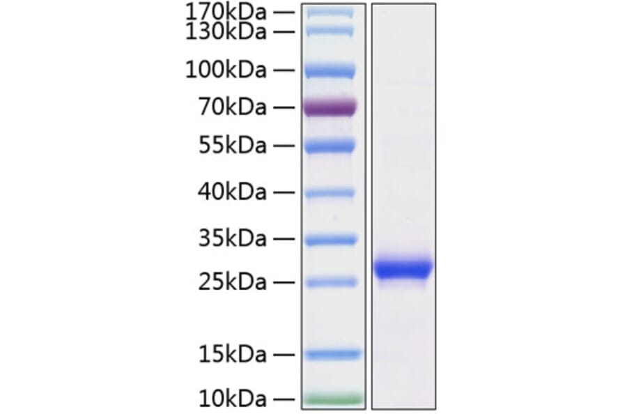 SDS-PAGE - Recombinant Rat Lipocalin-2 Protein (C-terminal His Tag) (A331734) - Antibodies.com