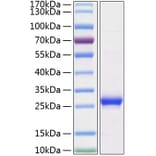 SDS-PAGE - Recombinant Rat Lipocalin-2 Protein (C-terminal His Tag) (A331734) - Antibodies.com