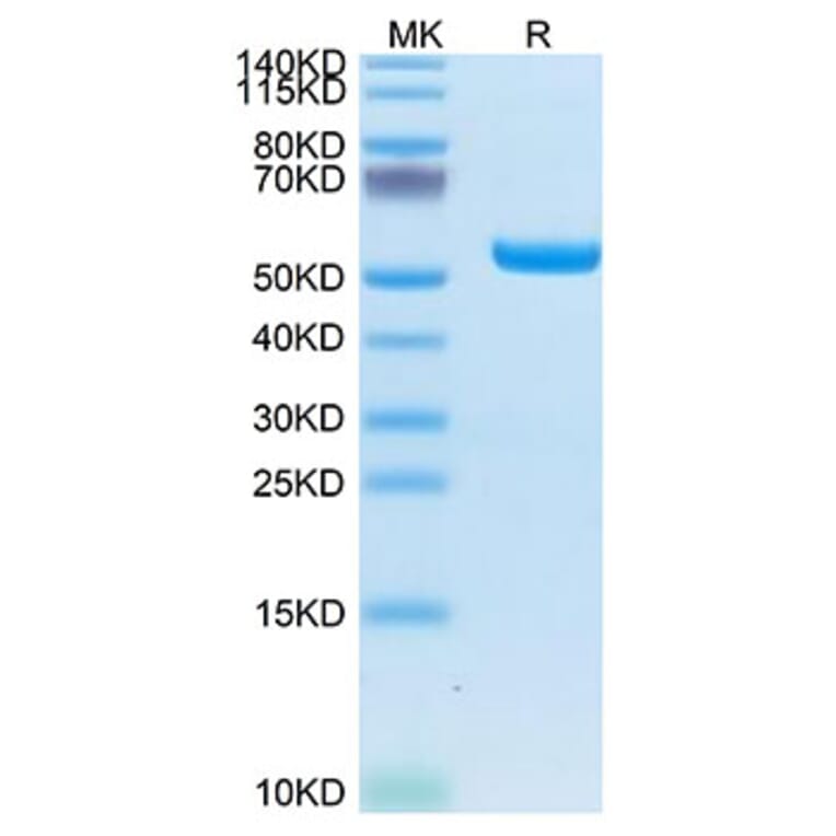 Tris-Bis PAGE - Recombinant Human AFP + HLA-A*02:01 Protein (C-terminal His and Avi Tag) (A331735) - Antibodies.com
