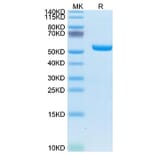 Tris-Bis PAGE - Recombinant Human AFP + HLA-A*02:01 Protein (C-terminal His and Avi Tag) (A331735) - Antibodies.com