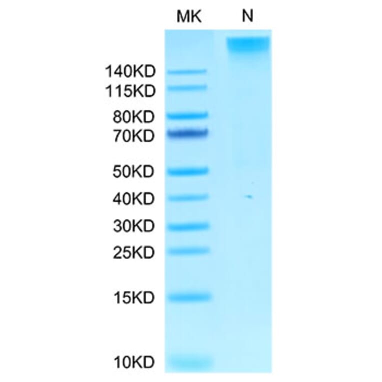 Tris-Bis PAGE - Recombinant Human AFP + HLA-A*02:01 Protein (C-terminal His and Avi Tag) (A331736) - Antibodies.com