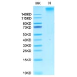 Tris-Bis PAGE - Recombinant Human AFP + HLA-A*02:01 Protein (C-terminal His and Avi Tag) (A331736) - Antibodies.com