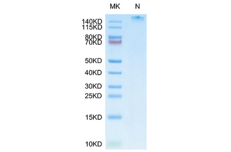 Tris-Bis PAGE - Recombinant Human LMP2 + HLA-A*11:01 Protein (C-terminal His and Avi Tag) (A331737) - Antibodies.com