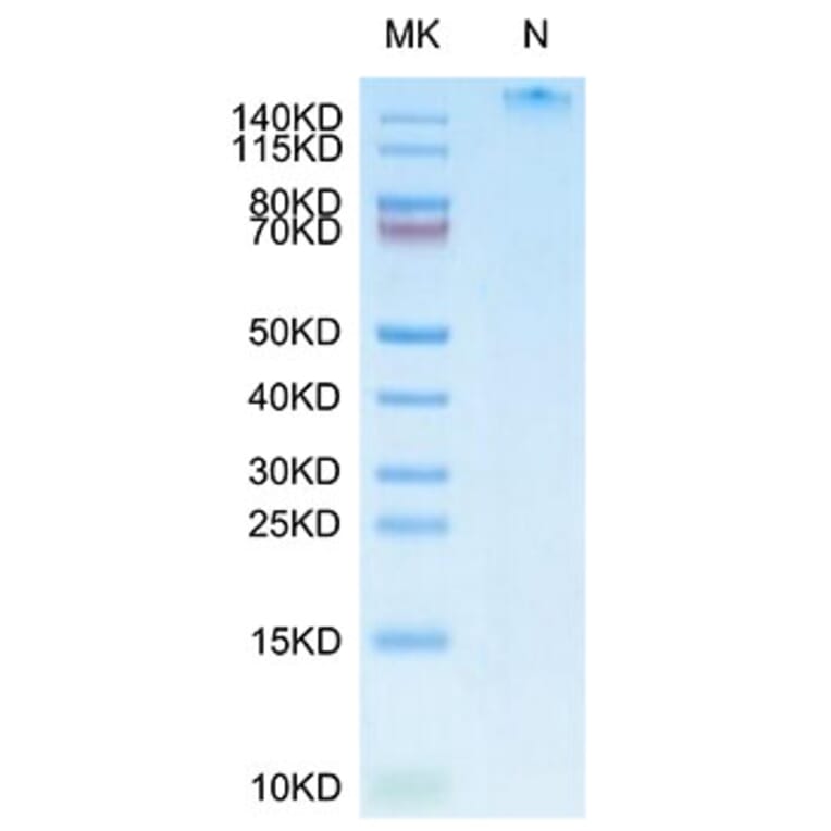 Tris-Bis PAGE - Recombinant Human LMP2 + HLA-A*11:01 Protein (C-terminal His and Avi Tag) (A331737) - Antibodies.com