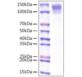 SDS-PAGE - Recombinant Mouse LDLR Protein (C-terminal His Tag) (A331738) - Antibodies.com