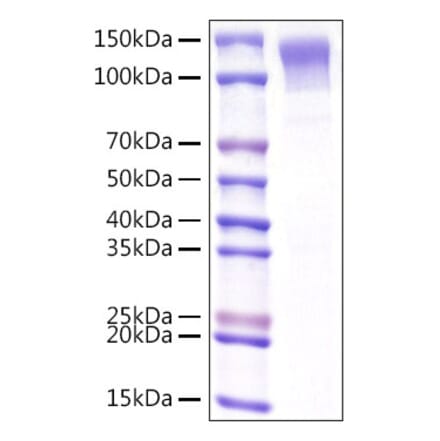 SDS-PAGE - Recombinant Mouse LDLR Protein (C-terminal His Tag) (A331738) - Antibodies.com