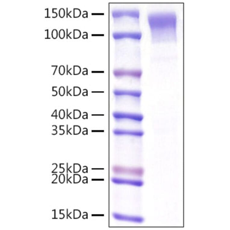 SDS-PAGE - Recombinant Mouse LDLR Protein (C-terminal His Tag) (A331738) - Antibodies.com