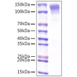 SDS-PAGE - Recombinant Mouse LDLR Protein (C-terminal His Tag) (A331738) - Antibodies.com