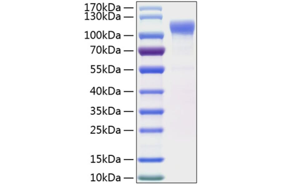 SDS-PAGE - Recombinant Human LRRC4 Protein (C-terminal His Tag) (A331739) - Antibodies.com