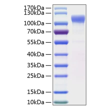 SDS-PAGE - Recombinant Human LRRC4 Protein (C-terminal His Tag) (A331739) - Antibodies.com