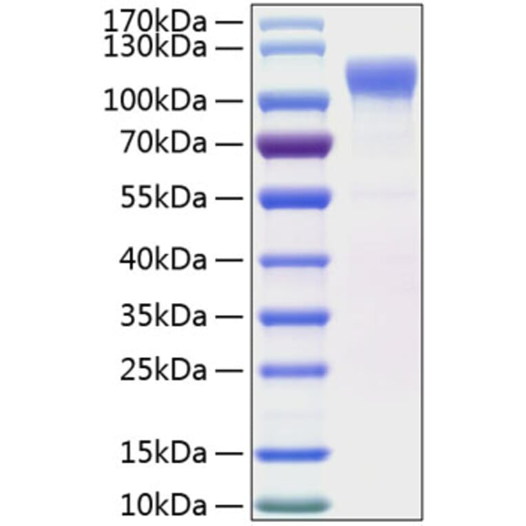 SDS-PAGE - Recombinant Human LRRC4 Protein (C-terminal His Tag) (A331739) - Antibodies.com