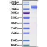 SDS-PAGE - Recombinant Human LRRC4 Protein (C-terminal His Tag) (A331739) - Antibodies.com