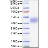 SDS-PAGE - Recombinant Mouse Lung surfactant Protein (C-terminal His Tag) (A331740) - Antibodies.com