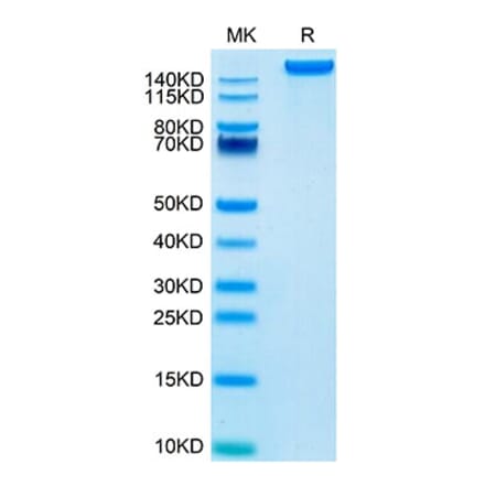 Tris-Bis PAGE - Recombinant Mouse Ly75 Protein (C-terminal His Tag) (A331741) - Antibodies.com