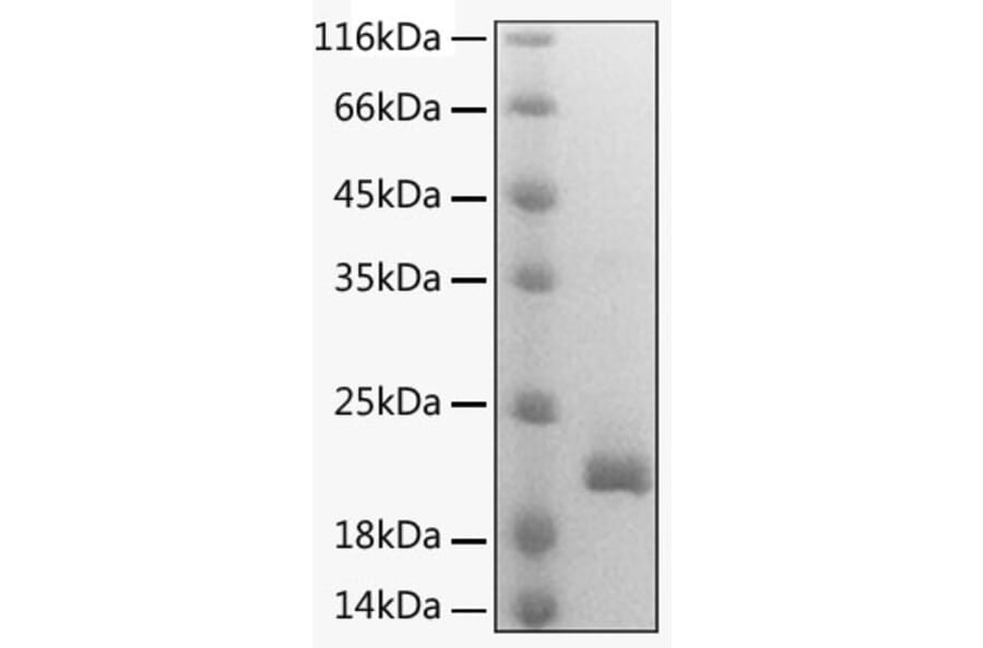 SDS-PAGE - Recombinant Mouse Lymphotactin Protein (C-terminal His Tag) (A331742) - Antibodies.com