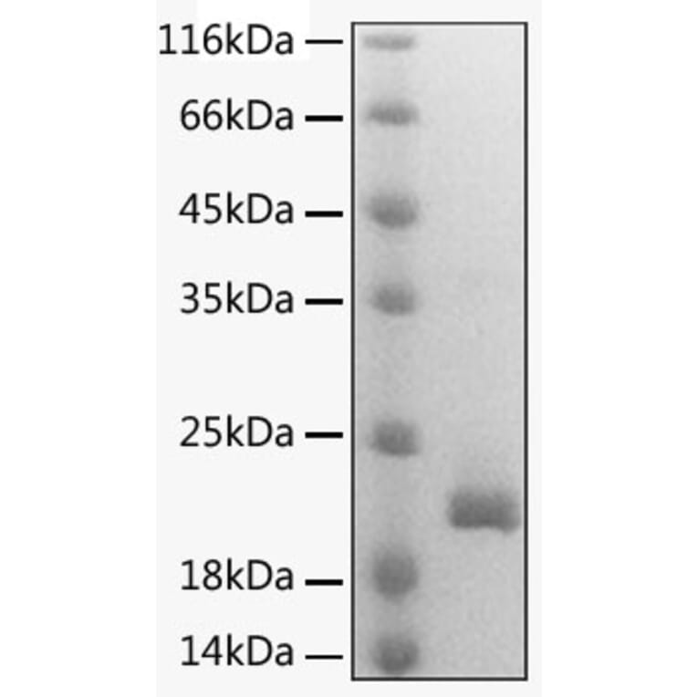SDS-PAGE - Recombinant Mouse Lymphotactin Protein (C-terminal His Tag) (A331742) - Antibodies.com