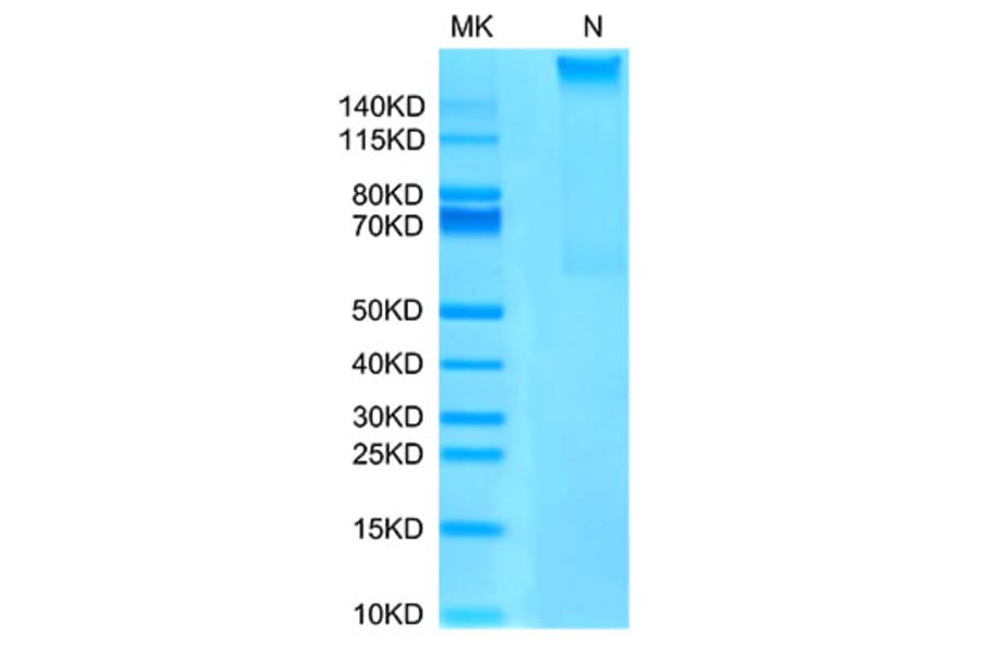 Tris-Bis PAGE - Recombinant Human AFP + HLA-A*02:01 Protein (C-terminal His and Avi Tag) (A331744) - Antibodies.com
