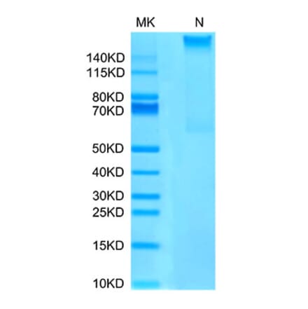 Tris-Bis PAGE - Recombinant Human AFP + HLA-A*02:01 Protein (C-terminal His and Avi Tag) (A331744) - Antibodies.com