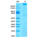 Tris-Bis PAGE - Recombinant Human AFP + HLA-A*02:01 Protein (C-terminal His and Avi Tag) (A331744) - Antibodies.com