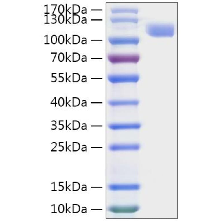 SDS-PAGE - Recombinant MERS-CoV Spike RBD Protein (C-terminal His Tag) (A331750) - Antibodies.com