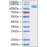 SDS-PAGE - Recombinant MERS-CoV Spike RBD Protein (C-terminal His Tag) (A331750) - Antibodies.com