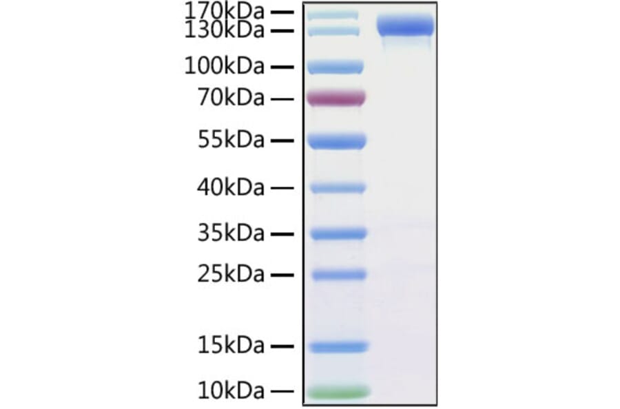 SDS-PAGE - Recombinant MERS-CoV Spike RBD Protein (C-terminal Mouse Fc Tag) (A331751) - Antibodies.com