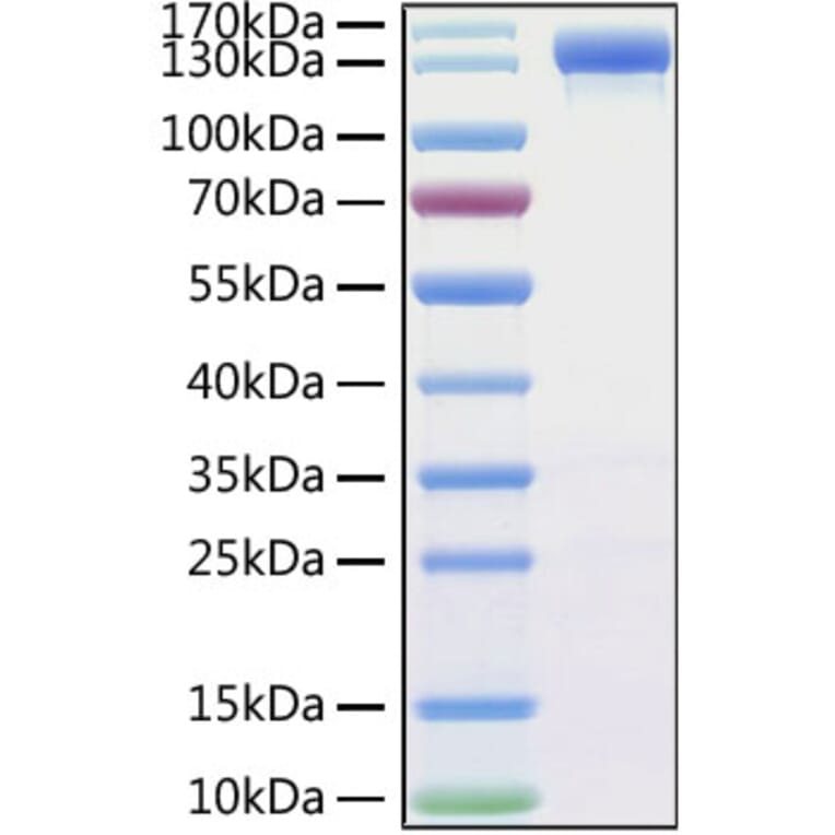 SDS-PAGE - Recombinant MERS-CoV Spike RBD Protein (C-terminal Mouse Fc Tag) (A331751) - Antibodies.com