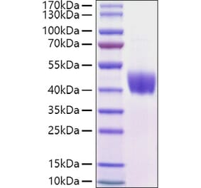 SDS-PAGE - Recombinant Mouse Mesothelin Protein (C-terminal His Tag) (A331752) - Antibodies.com