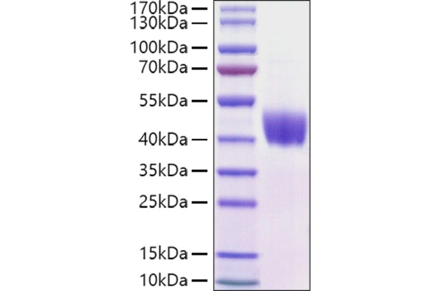 SDS-PAGE - Recombinant Mouse Mesothelin Protein (C-terminal His Tag) (A331752) - Antibodies.com